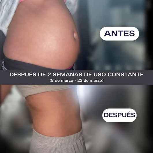 Verdalia® - Adiós Hinchazón